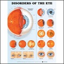 Disorder of Eye - Poster