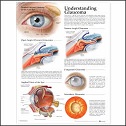 Glaucoma - Poster